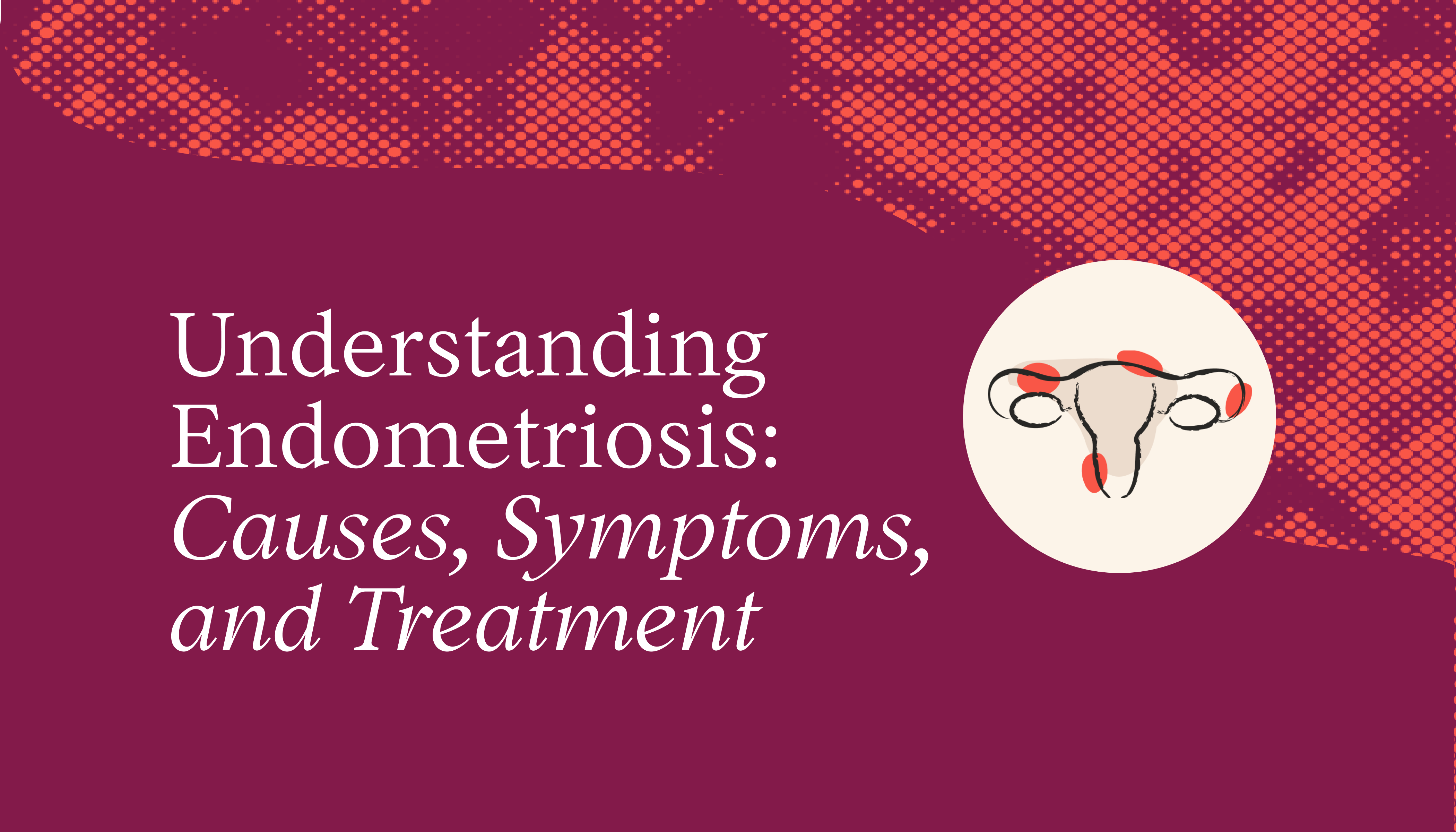 endometriosis treatment in delhi