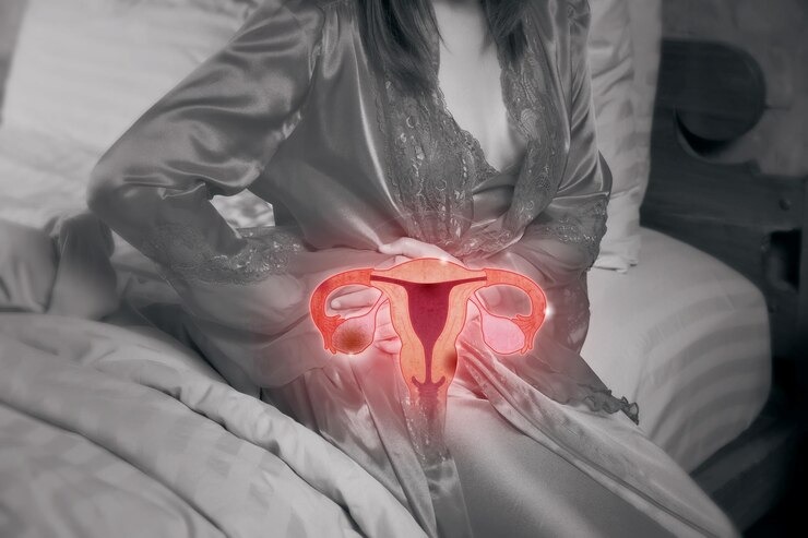 Herbal-Logic-in-a-Hyperconnected-City-Ayurveda-for-Endometriosis-Treatment-in-Delhi