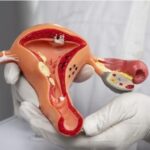 tubal blockage treatment in delhi