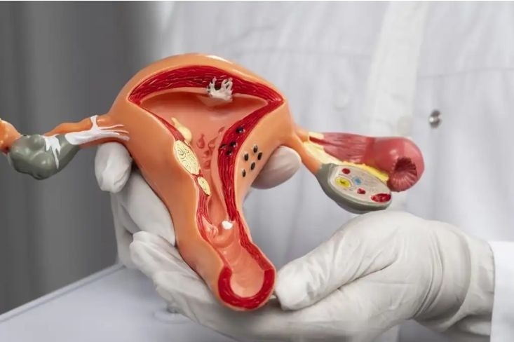 tubal blockage treatment in delhi